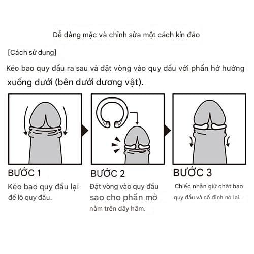 Vòng đeo đầu khấc chống hẹp bao quy đầu My Peace Nhật Bản